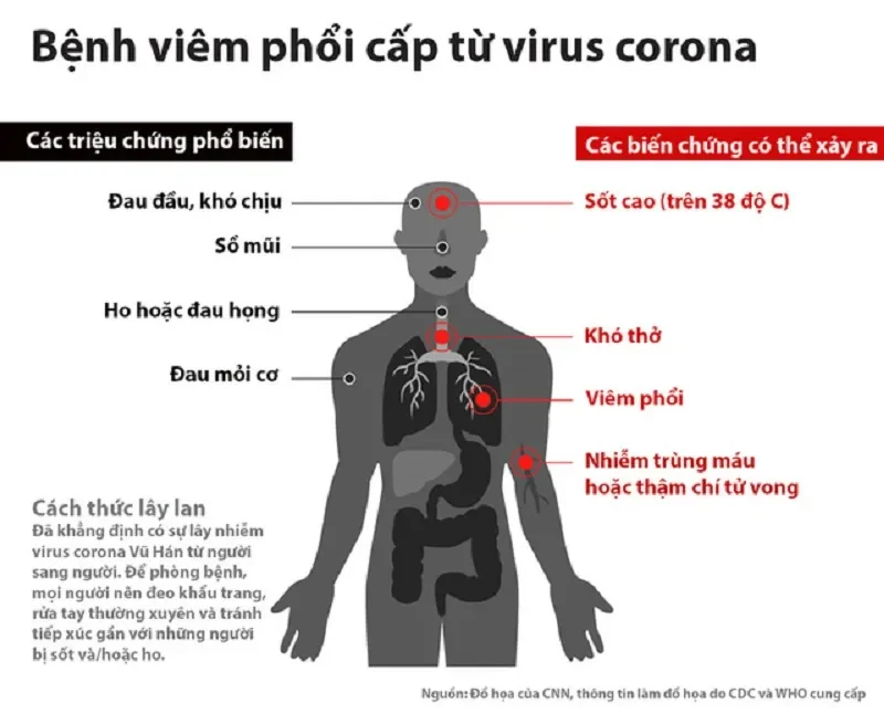 "Điểm mặt" những biến chứng cúm mùa nguy hiểm thường gặp