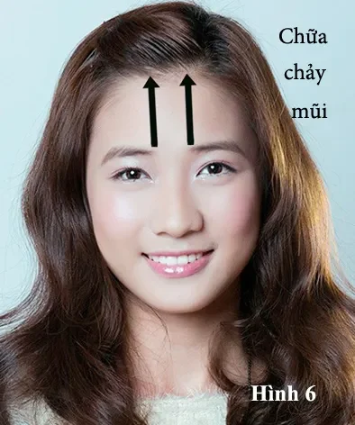 . Cúm (Influenza) - "Anh em" của cảm lạnh, nhưng "khó chịu" hơn