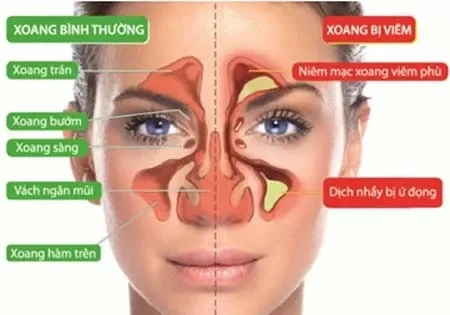 "Lý giải" hiện tượng nghẹt mũi khi trời lạnh: "Bí mật" đằng sau chiếc mũi "khó ở"